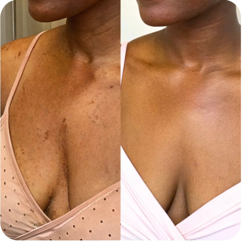 Pads nettoyant 🧽 au curcuma 🫧