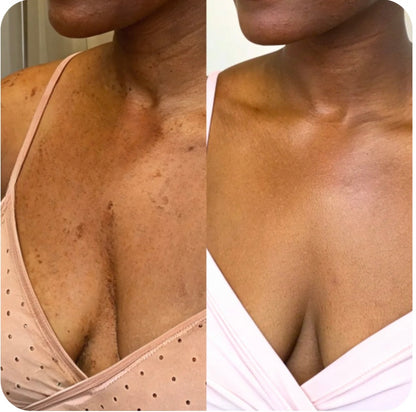 Pads nettoyant 🧽 au curcuma 🫧