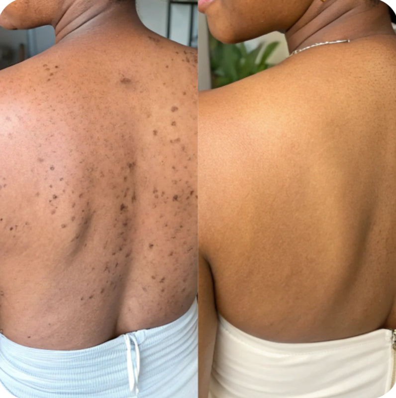 Pads nettoyant 🧽 au curcuma 🫧