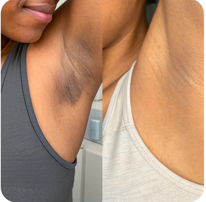 Pads nettoyant 🧽 au curcuma 🫧