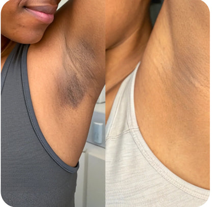 Pads nettoyant 🧽 au curcuma 🫧