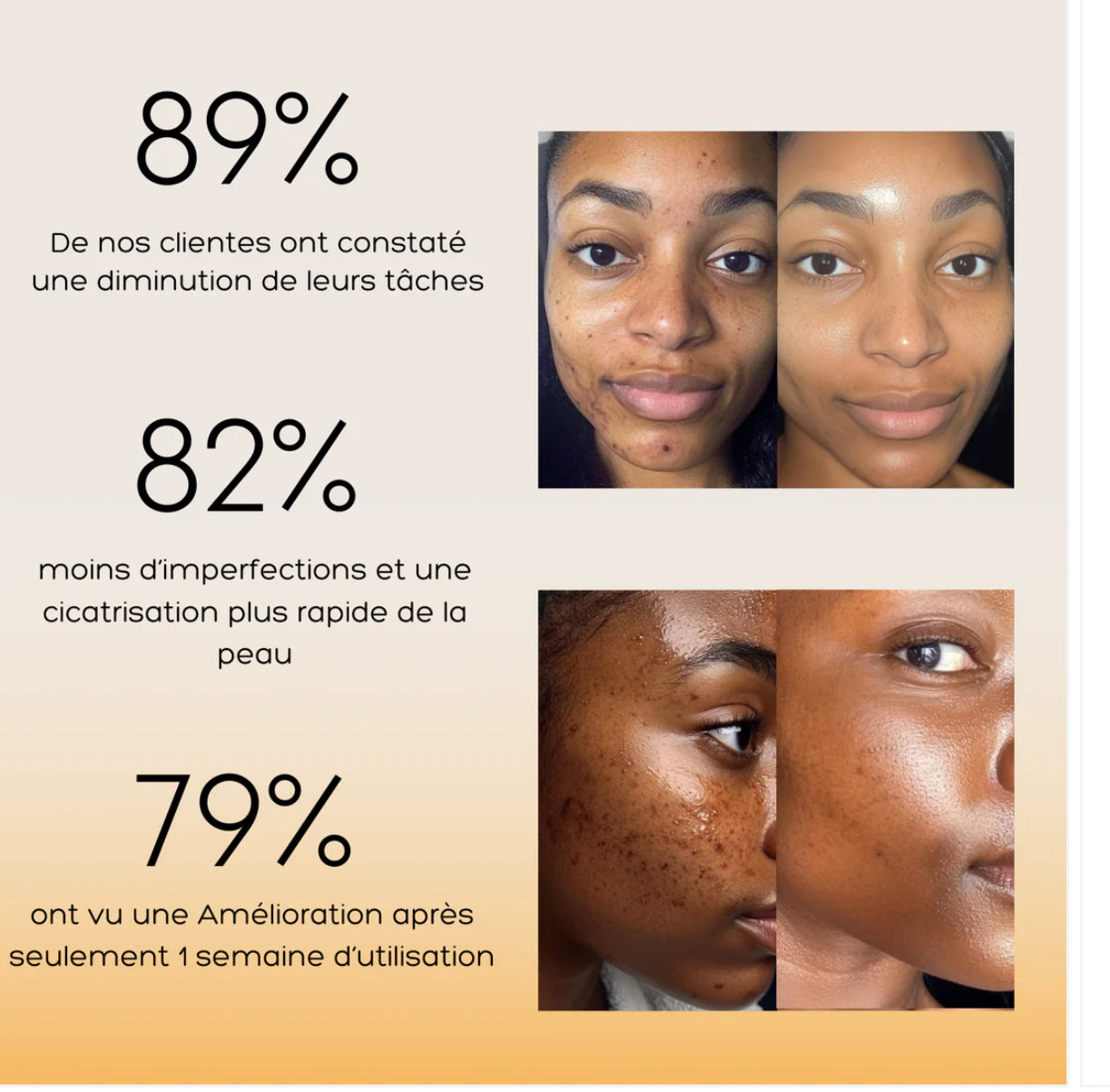 Pads nettoyant 🧽 au curcuma 🫧