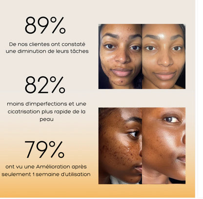 Pads nettoyant 🧽 au curcuma 🫧