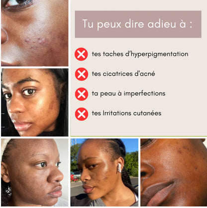 Pads nettoyant 🧽 au curcuma 🫧