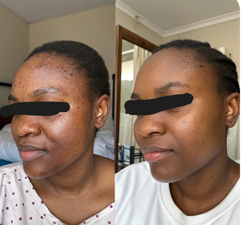 Pads nettoyant 🧽 au curcuma 🫧