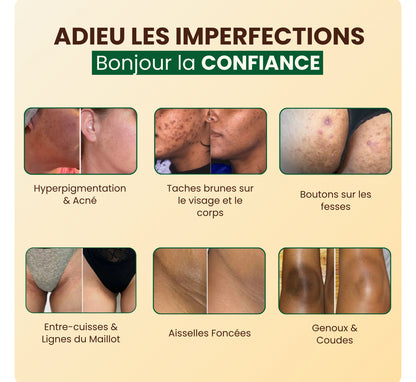 Savon au curcuma
