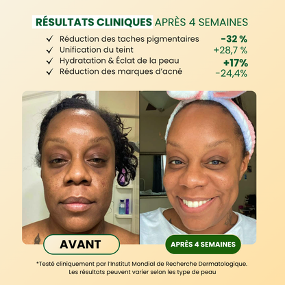Savon au curcuma